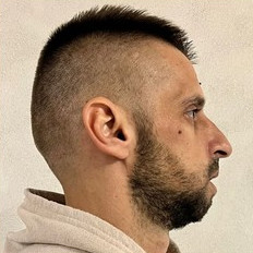 Profil pacient după chirurgie ortognatică EAN Clinic
