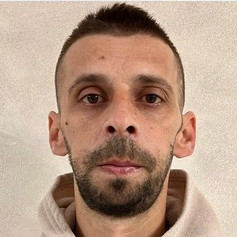 Frontal pacient după chirurgie ortognatică EAN Clinic