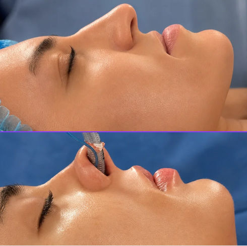 Planificare 3D structuri faciale chirurgie ortognatică EAN Clinic