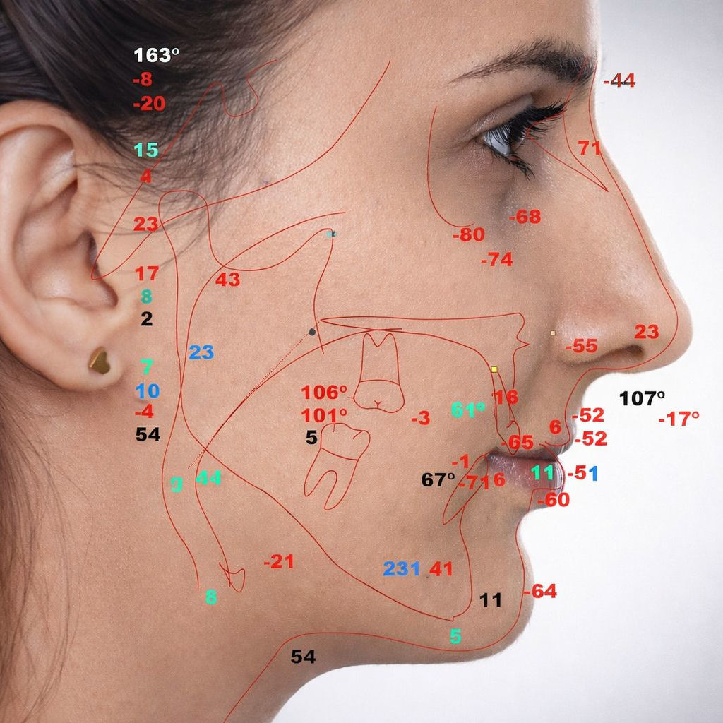 Tehnologie planificare chirurgie ortognatică EAN Clinic - imagine 1