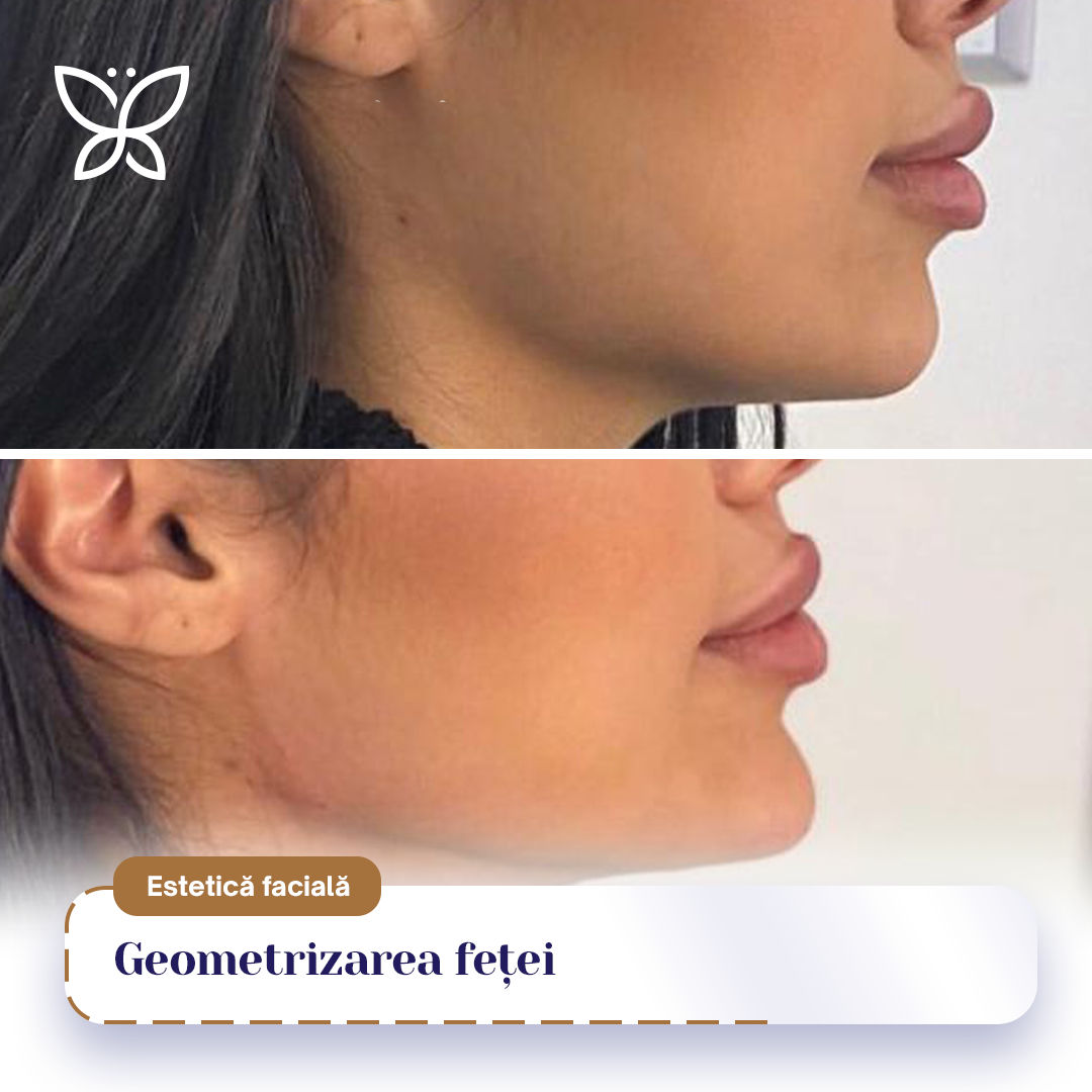 Geometrizarea feței