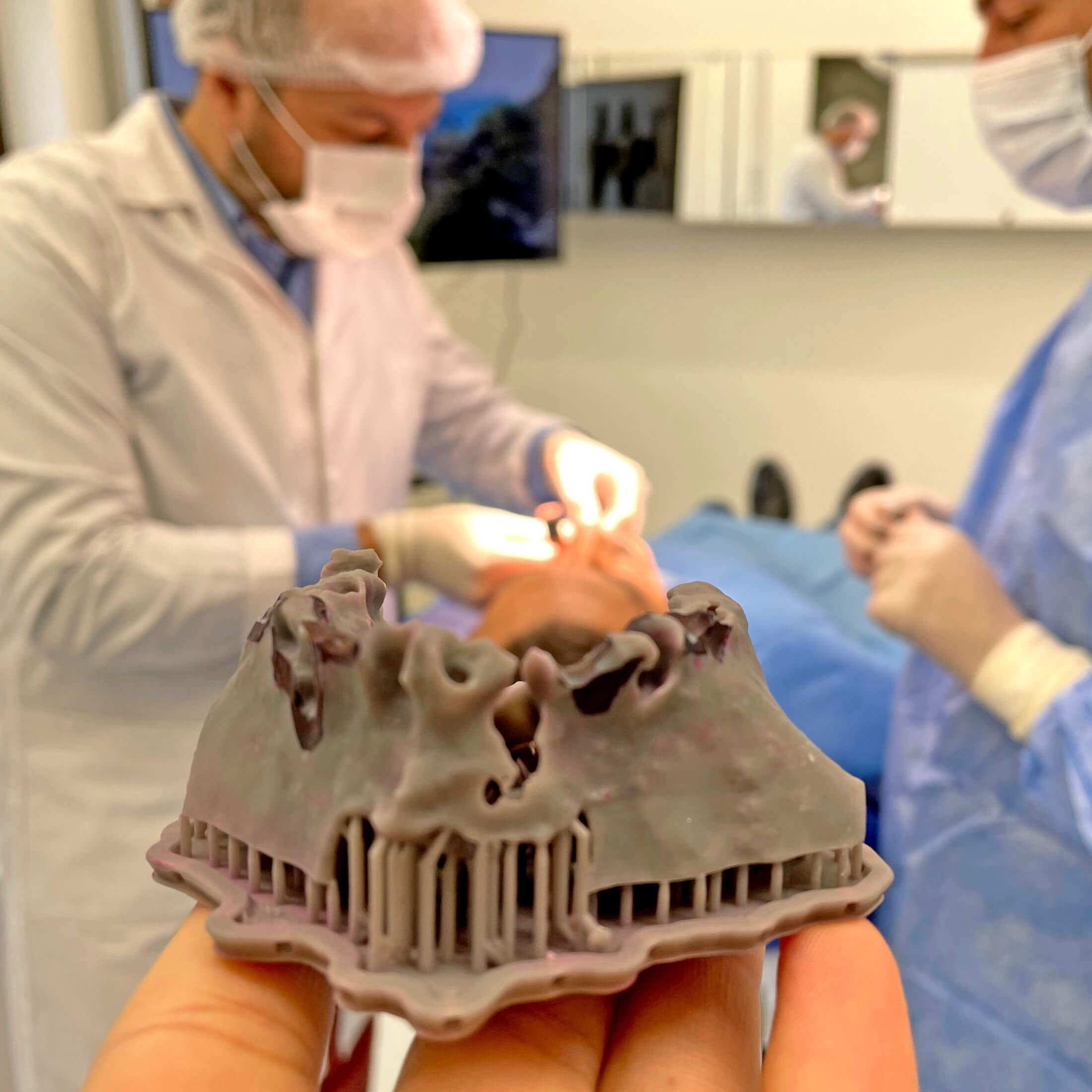 Tipuri de implant dentar — EAN Clinic