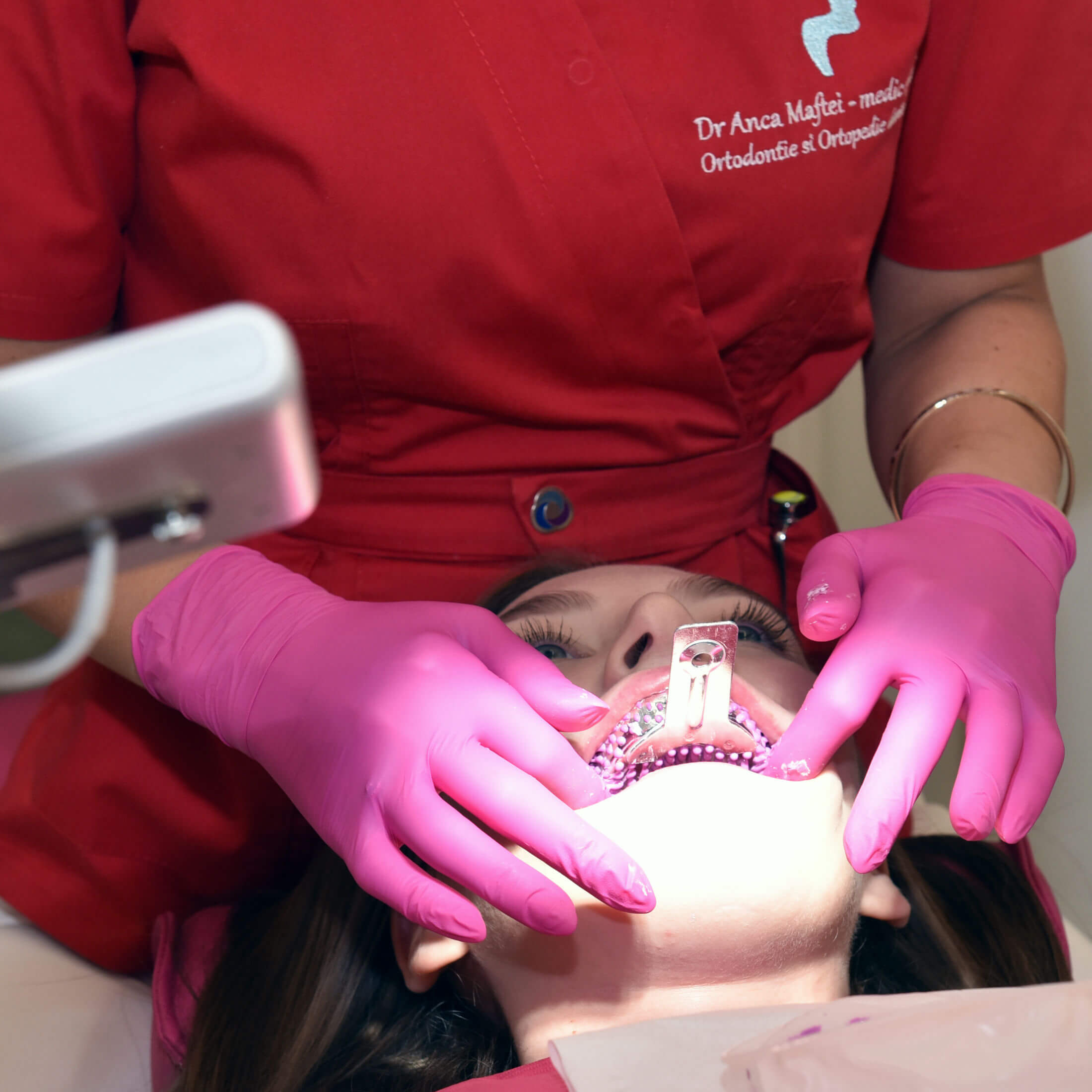 Aplicarea aparatului dentar
