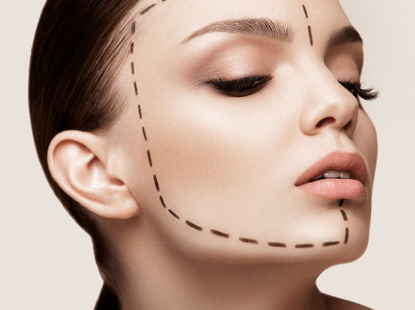 Reconturare facială