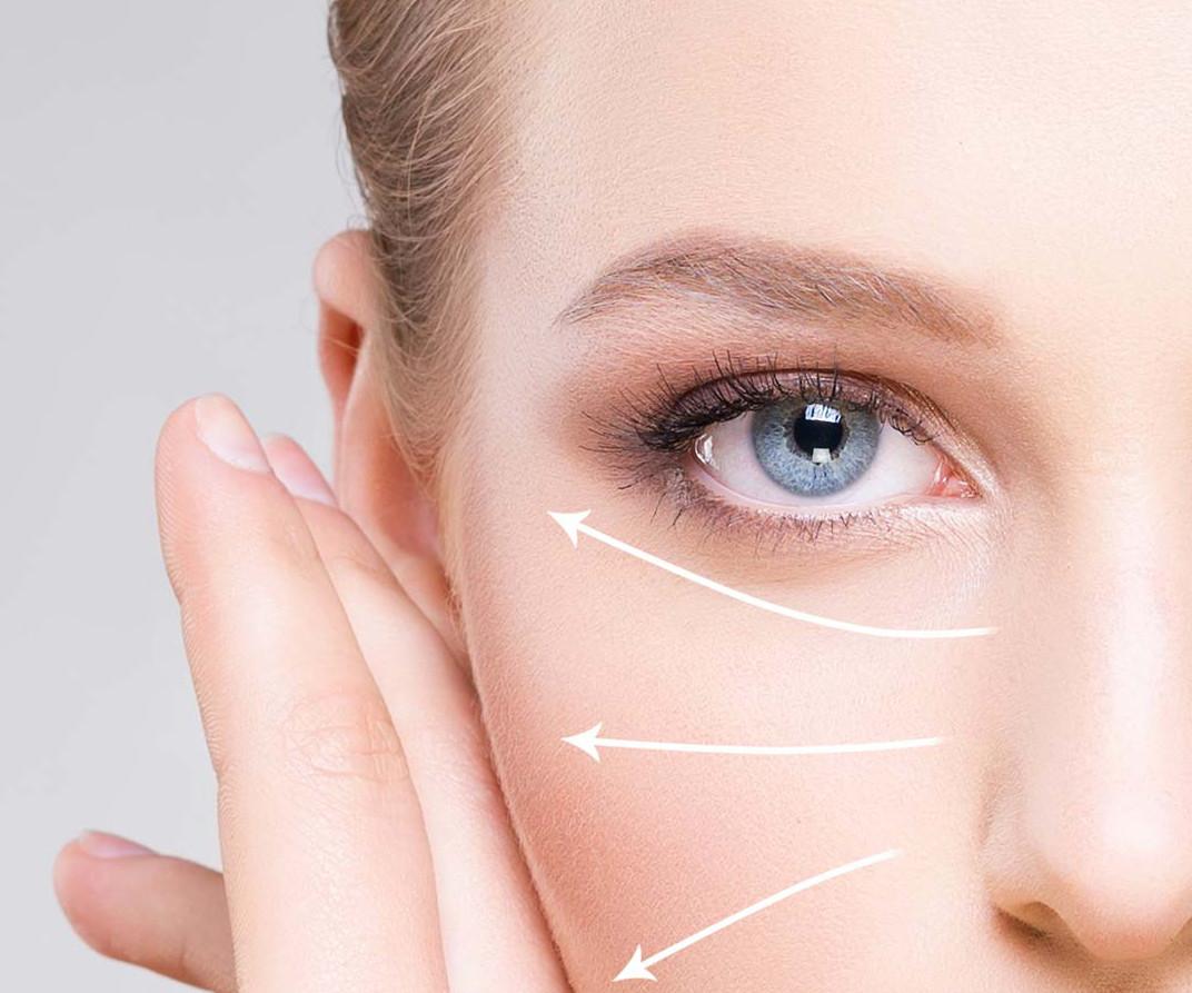 Lifting facial