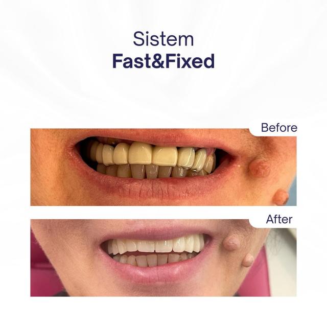 Sistem Fast&Fixed