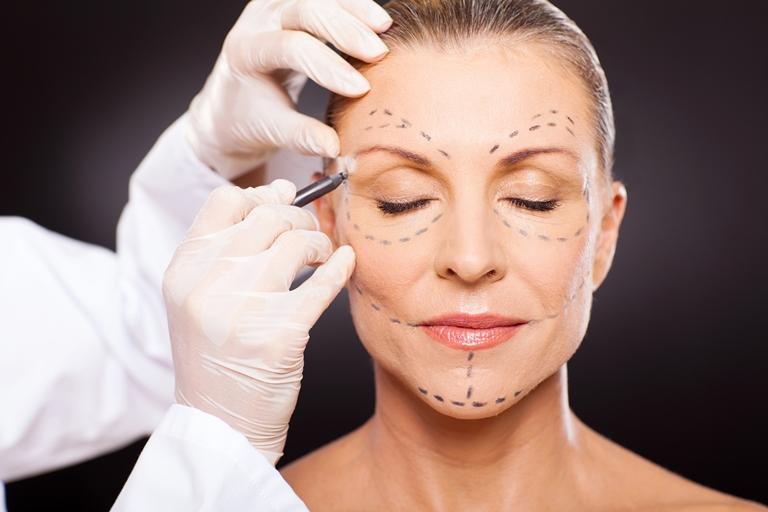 Lifting-ul facial, soluția pentru o nouă tinerețe